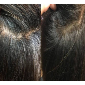 Black Hair Set - Silver Hair Switching To Black Shampoo Shampoo And Conditioner Black Sachet From Viet Nam Manufacturer Hair Black Castor Oil 2